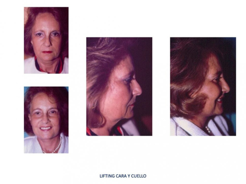 Slider image (5) ProEsthetik